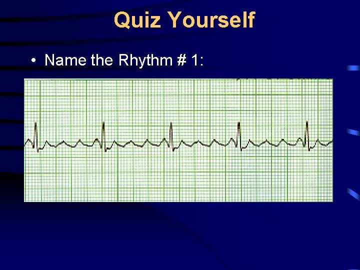 Quiz Yourself • Name the Rhythm # 1: 