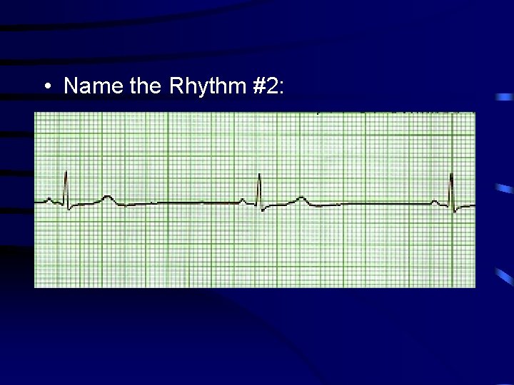  • Name the Rhythm #2: 