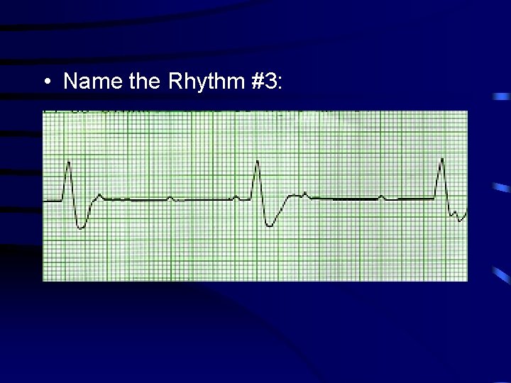  • Name the Rhythm #3: 