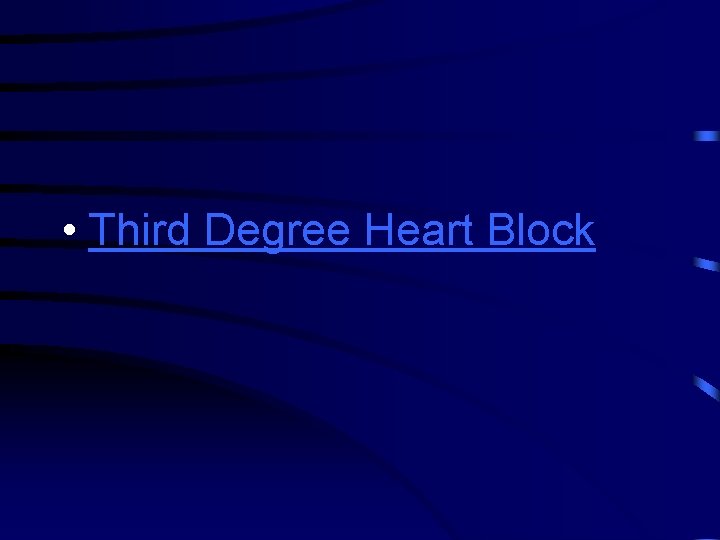  • Third Degree Heart Block 