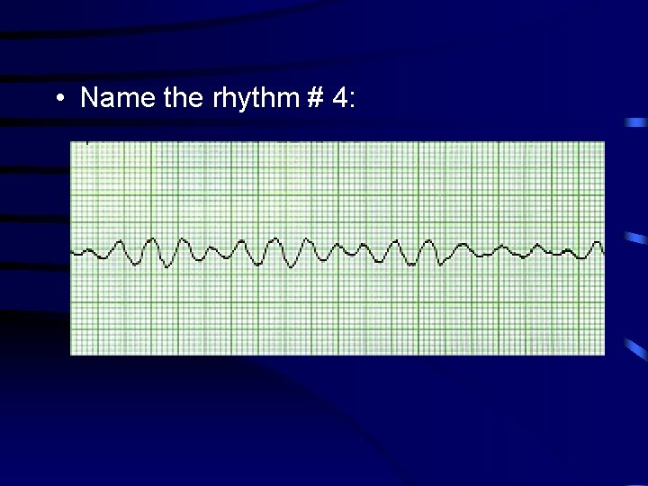  • Name the rhythm # 4: 