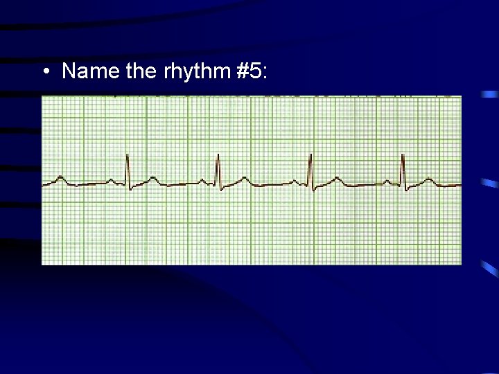  • Name the rhythm #5: 