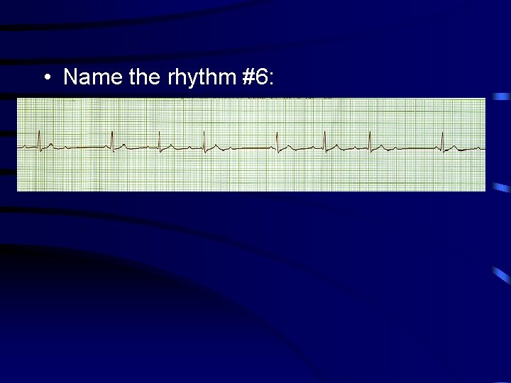  • Name the rhythm #6: 