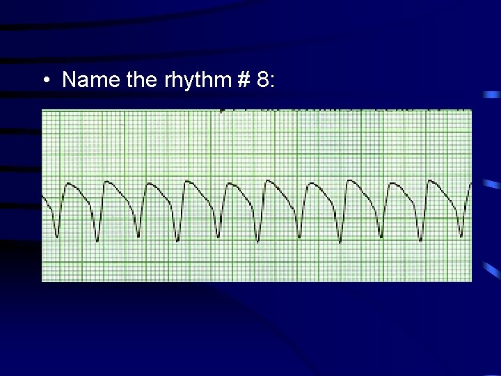  • Name the rhythm # 8: 