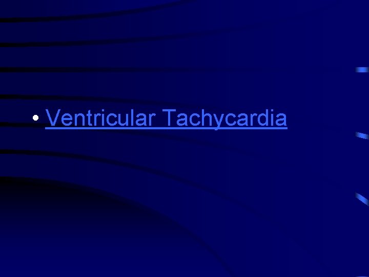  • Ventricular Tachycardia 