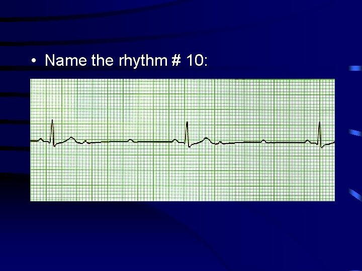  • Name the rhythm # 10: 