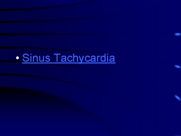  • Sinus Tachycardia 