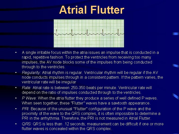Atrial Flutter • • • A single irritable focus within the atria issues an