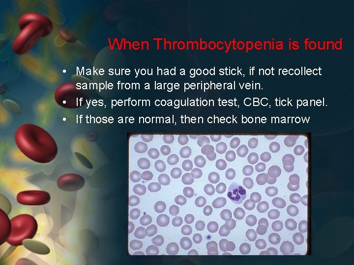 When Thrombocytopenia is found • Make sure you had a good stick, if not
