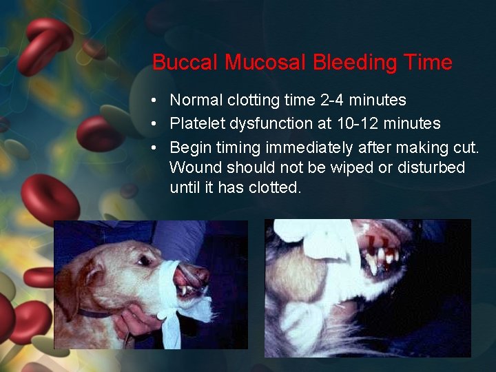 Buccal Mucosal Bleeding Time • Normal clotting time 2 -4 minutes • Platelet dysfunction