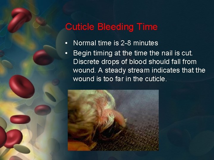 Cuticle Bleeding Time • Normal time is 2 -8 minutes • Begin timing at
