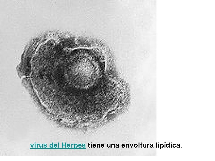 virus del Herpes tiene una envoltura lipídica. 