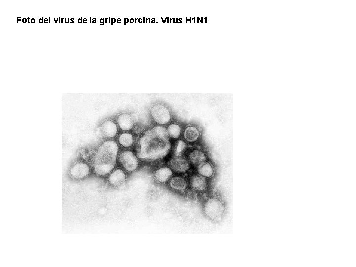 Foto del virus de la gripe porcina. Virus H 1 N 1 