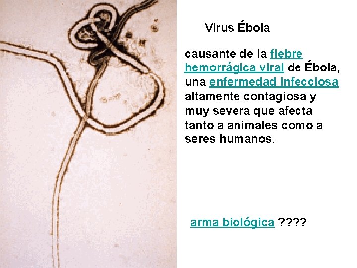 Virus Ébola causante de la fiebre hemorrágica viral de Ébola, una enfermedad infecciosa altamente