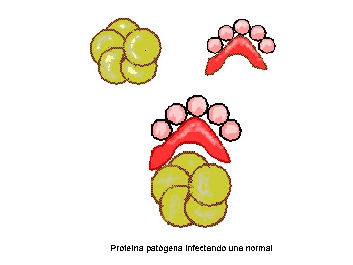 Proteína patógena infectando una normal 