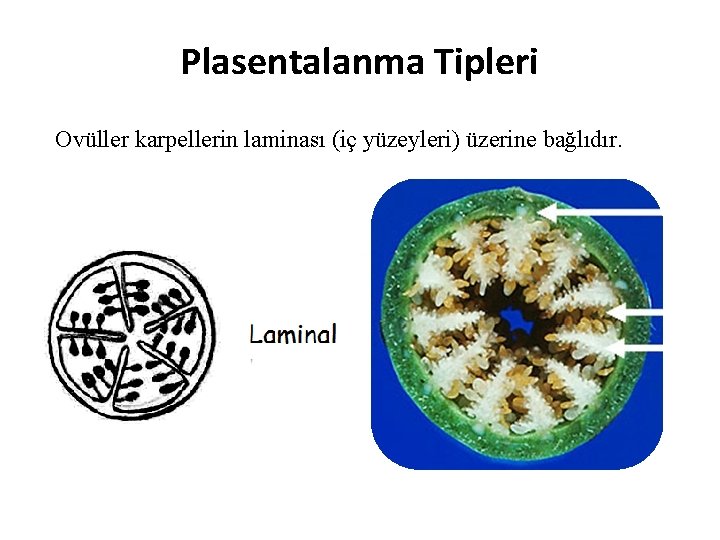 Plasentalanma Tipleri Ovüller karpellerin laminası (iç yüzeyleri) üzerine bağlıdır. 