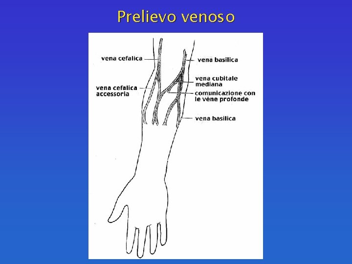 Prelievo venoso 