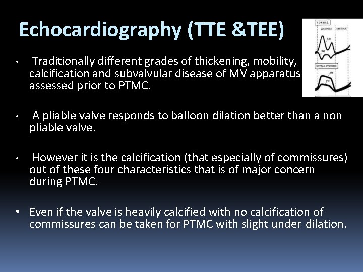 Echocardiography (TTE &TEE) • Traditionally different grades of thickening, mobility, calcification and subvalvular disease