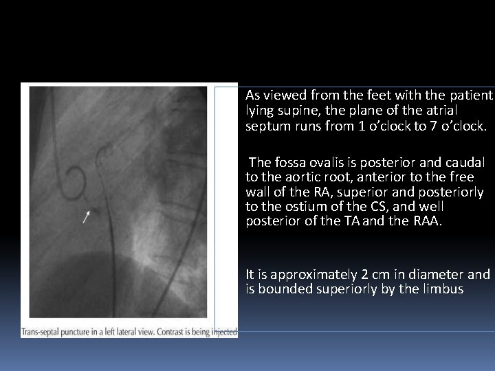  • As viewed from the feet with the patient lying supine, the plane