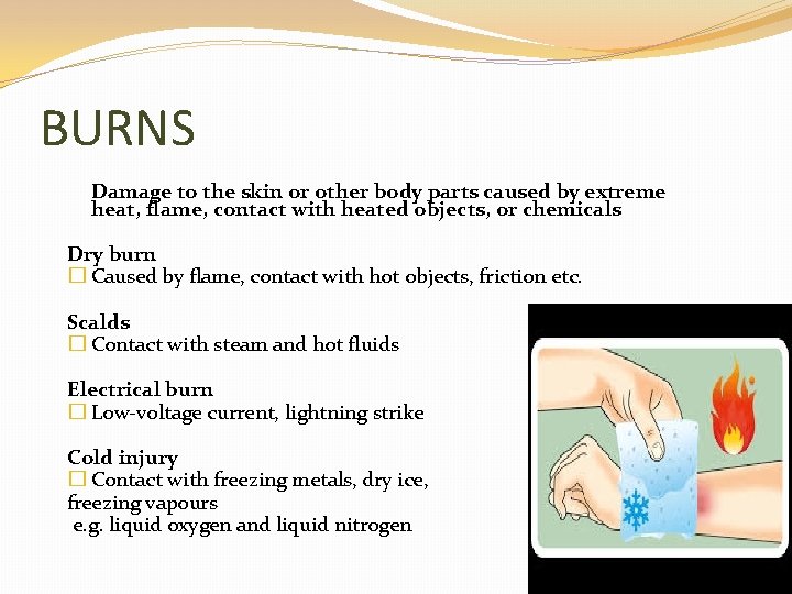 BURNS Damage to the skin or other body parts caused by extreme heat, flame,