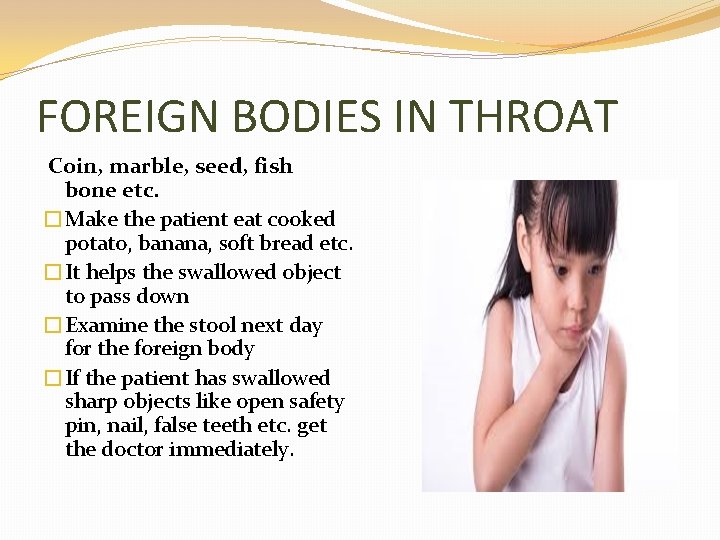 FOREIGN BODIES IN THROAT Coin, marble, seed, fish bone etc. �Make the patient eat