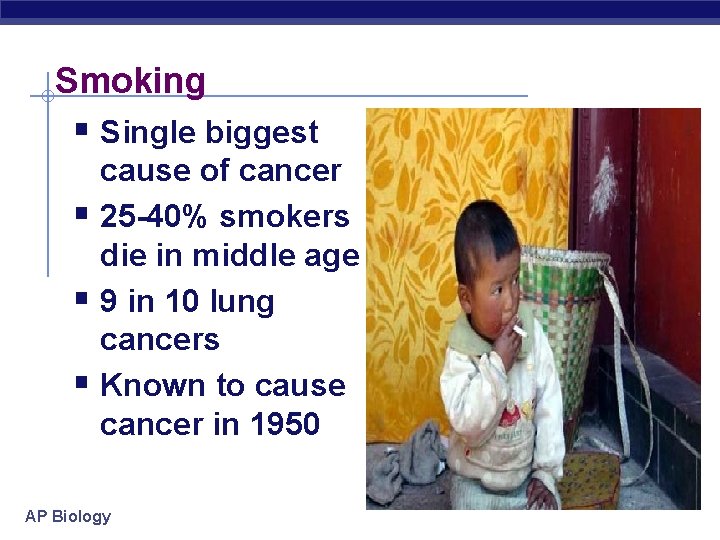Smoking § Single biggest cause of cancer § 25 -40% smokers die in middle