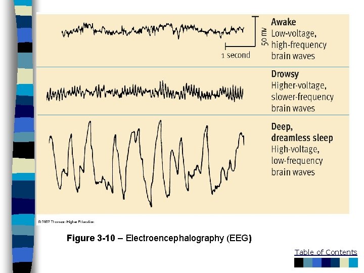 Figure 3 -10 – Electroencephalography (EEG) Table of Contents 