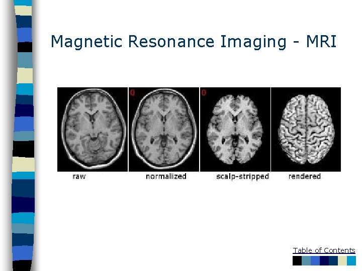 Magnetic Resonance Imaging - MRI Table of Contents 