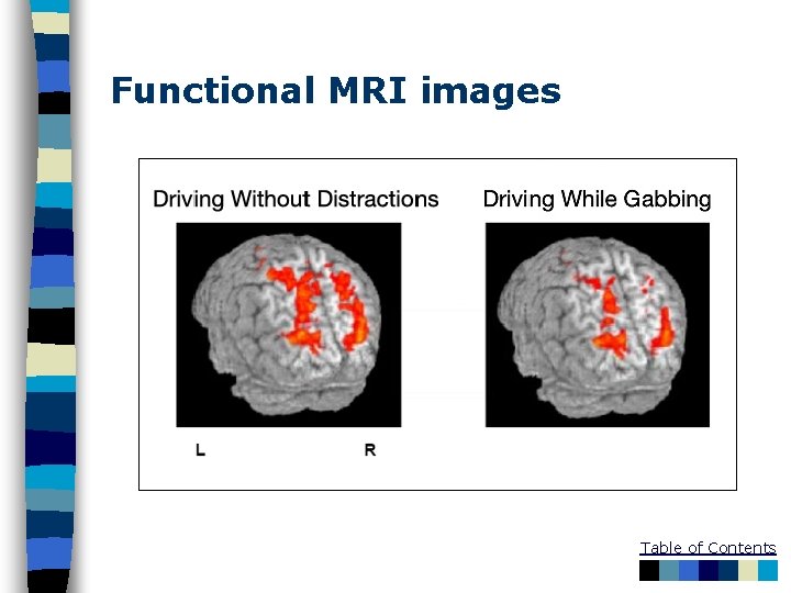 Functional MRI images Table of Contents 