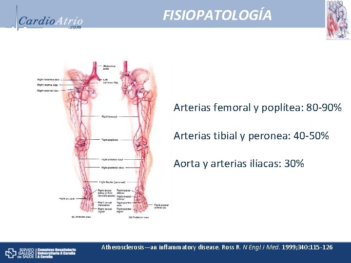 FISIOPATOLOGÍA Arterias femoral y poplítea: 80 -90% Arterias tibial y peronea: 40 -50% Aorta