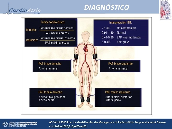 DIAGNÓSTICO ACC/AHA 2005 Practice Guidelines for the Management of Patients With Peripheral Arterial Disease.
