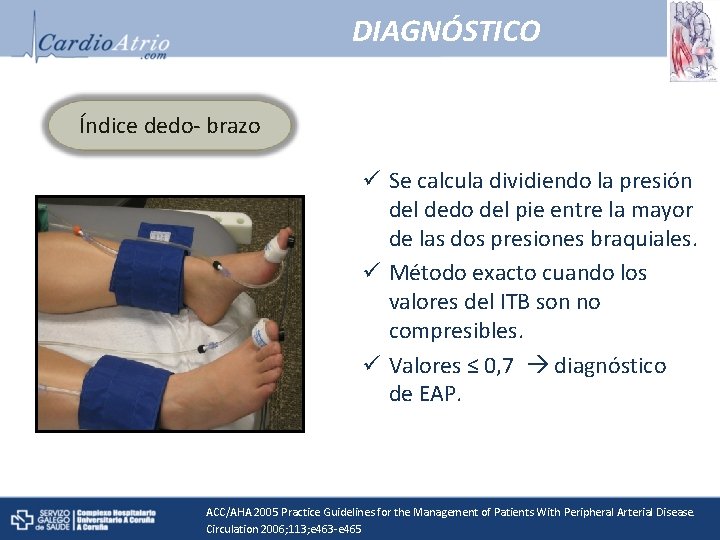 DIAGNÓSTICO Índice dedo- brazo ü Se calcula dividiendo la presión del dedo del pie