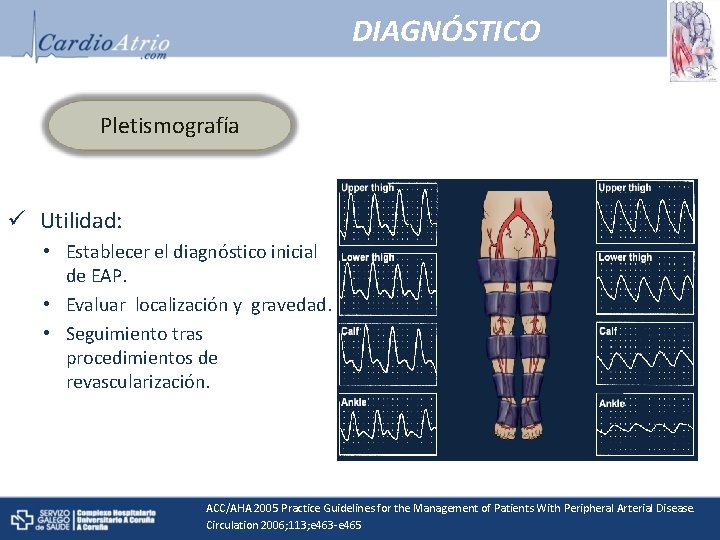 DIAGNÓSTICO Pletismografía ü Utilidad: • Establecer el diagnóstico inicial de EAP. • Evaluar localización