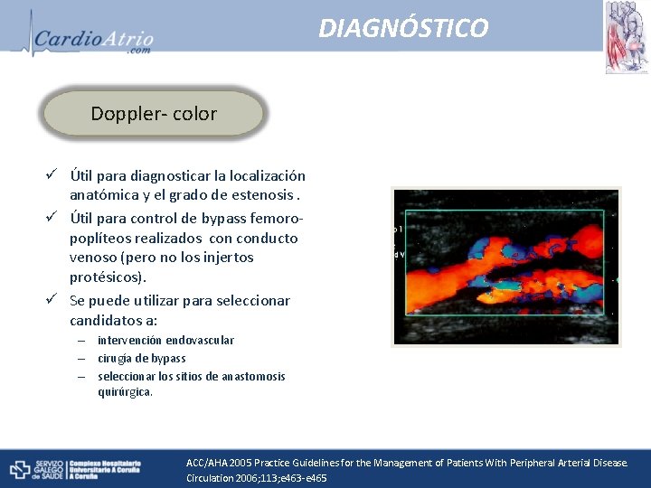 DIAGNÓSTICO Doppler- color ü Útil para diagnosticar la localización anatómica y el grado de