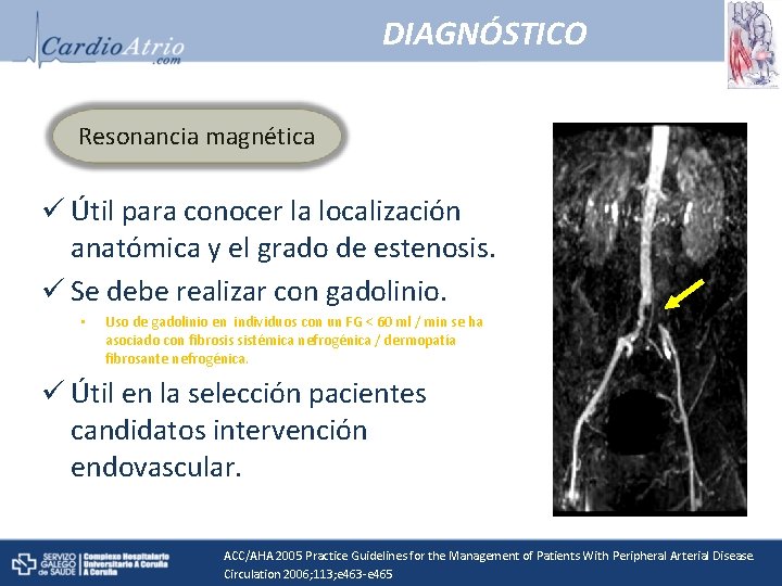 DIAGNÓSTICO Resonancia magnética ü Útil para conocer la localización anatómica y el grado de