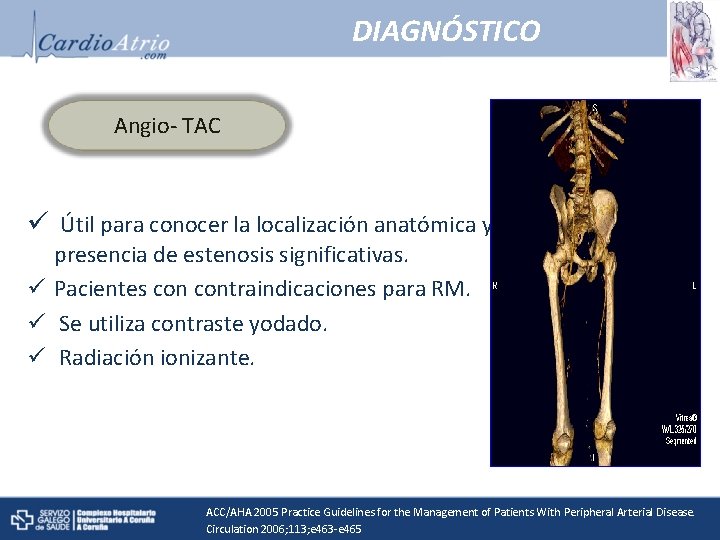 DIAGNÓSTICO Angio- TAC ü Útil para conocer la localización anatómica y presencia de estenosis