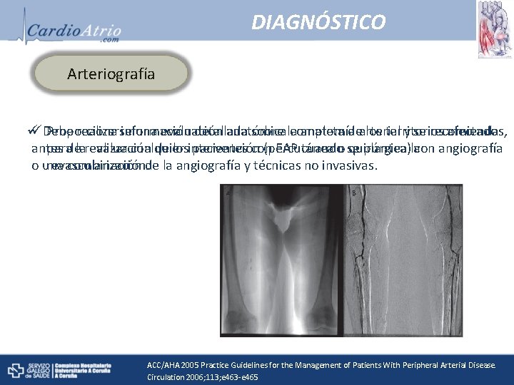 DIAGNÓSTICO Arteriografía ü üDebe Proporciona realizarse información una evaluación detallada anatómica sobre la completa