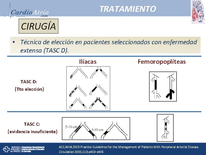 TRATAMIENTO CIRUGÍA • Técnica de elección en pacientes seleccionados con enfermedad extensa (TASC D).