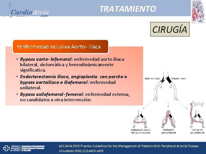 TRATAMIENTO CIRUGÍA • Enfermedad oclusiva Aorto- ilíaca • Bypass aorto- bifemoral: enfermedad aorto ilíaca