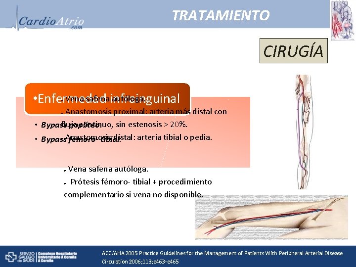 TRATAMIENTO CIRUGÍA Vena safenainfrainguinal autóloga. • Enfermedad o Anastomosis proximal: arteria más distal con