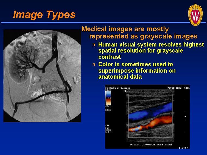 Image Types Medical images are mostly represented as grayscale images Human visual system resolves Image Types Medical images are mostly represented as grayscale images Human visual system resolves