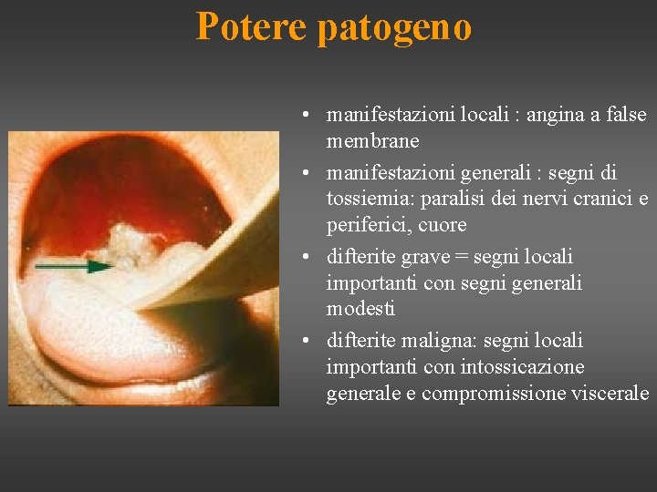 Potere patogeno • manifestazioni locali : angina a false membrane • manifestazioni generali :