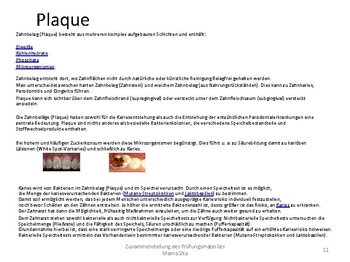 Plaque Zahnbelag (Plaque) besteht aus mehreren komplex aufgebauten Schichten und enthält: Eiweiße Kohlenhydrate Phosphate