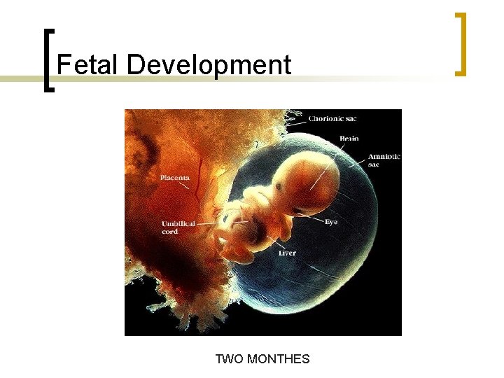 Fetal Development TWO MONTHES 