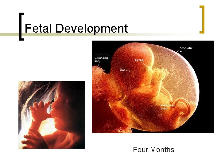 Fetal Development Four Months 