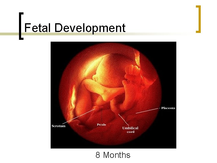 Fetal Development 8 Months 