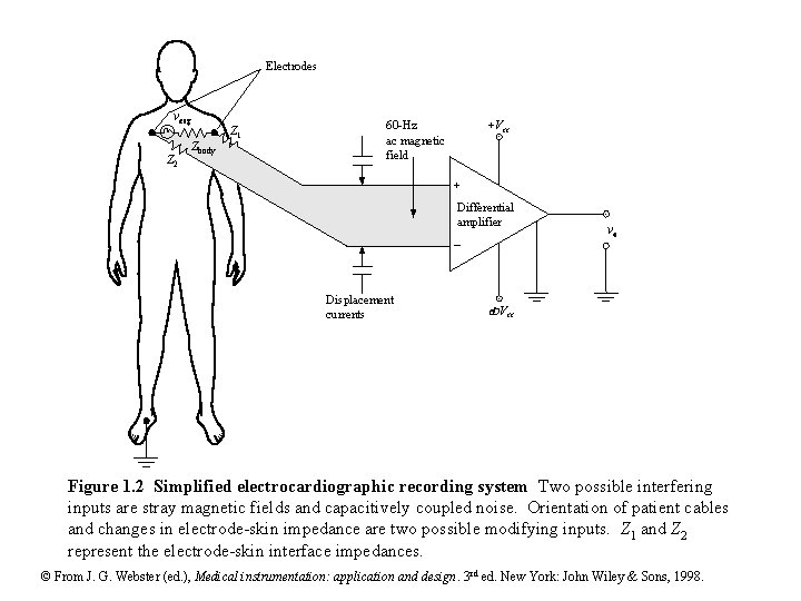 Electrodes vecg Z 2 Zbody Z 1 +Vcc 60 -Hz ac magnetic field + Electrodes vecg Z 2 Zbody Z 1 +Vcc 60 -Hz ac magnetic field +