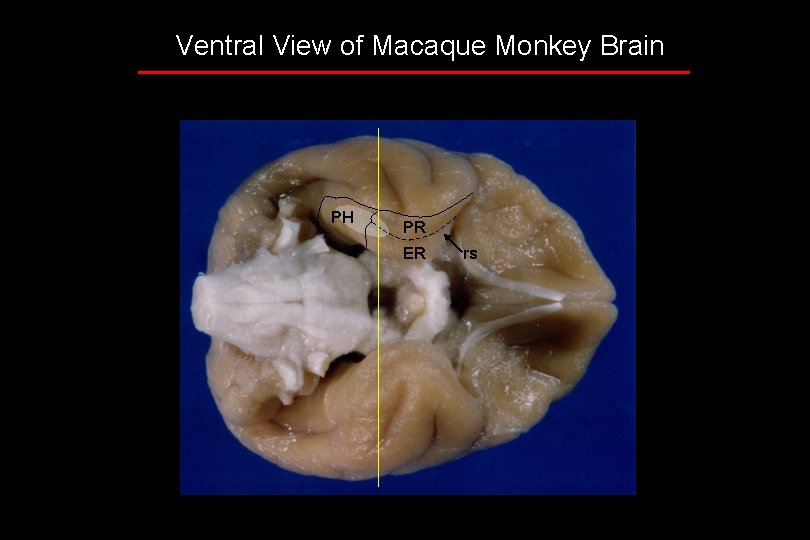 Ventral View of Macaque Monkey Brain PH PR ER rs 