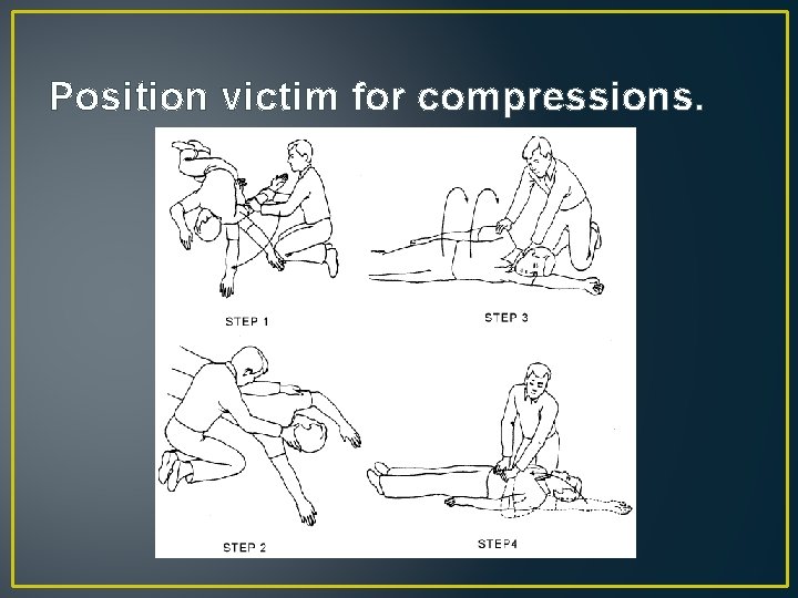 Position victim for compressions. 