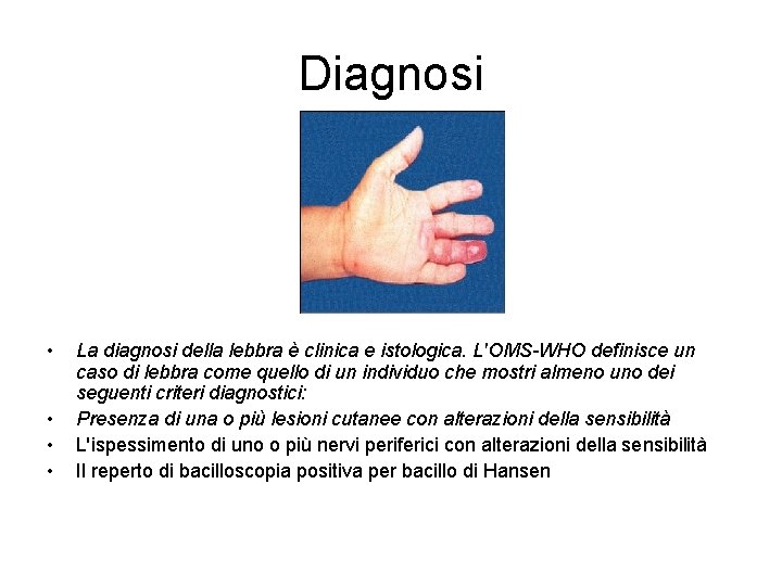 Diagnosi • • La diagnosi della lebbra è clinica e istologica. L'OMS-WHO definisce un